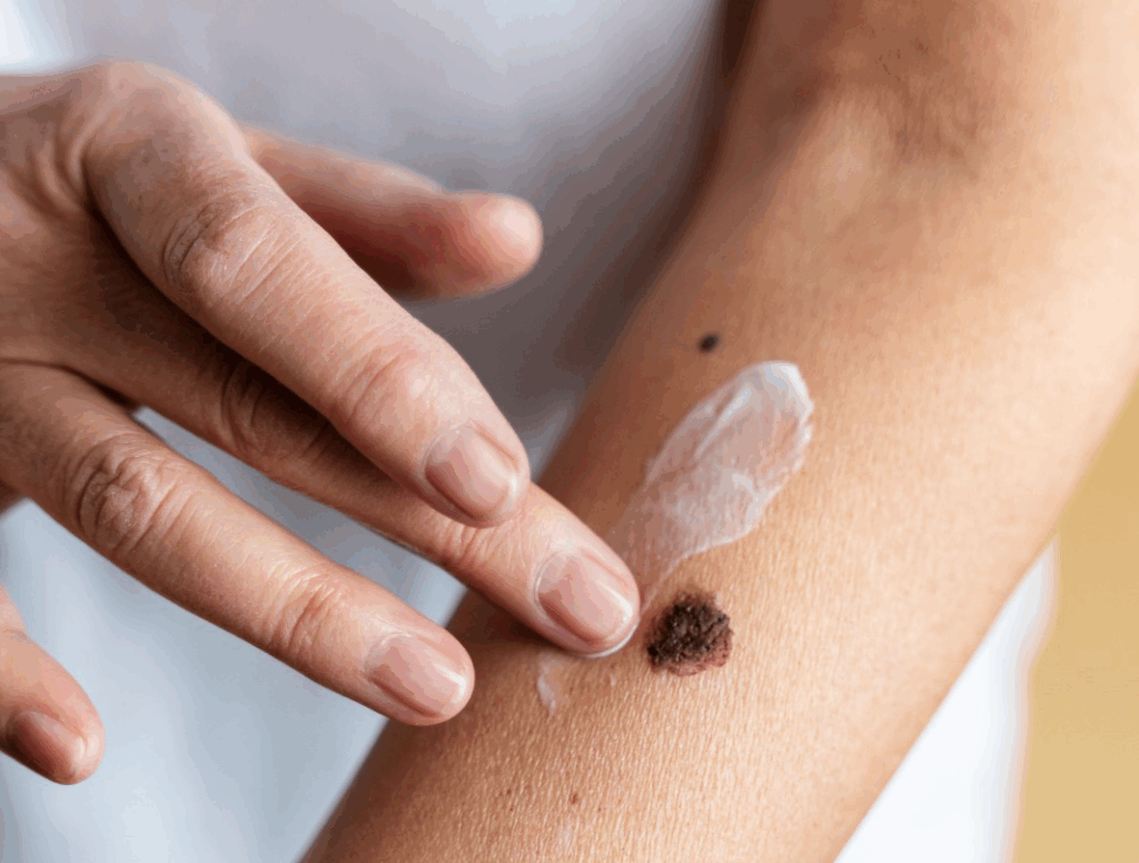 Persona consultando con dermatólogo por lesión cutánea